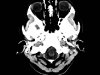 Rat Skull